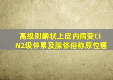 高级别鳞状上皮内病变CIN2级伴累及腺体俗称原位癌